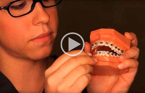 AAO Brushing and Flossing video - Kita Orthodontics in North Little Rock, Jacksonville and Maumelle, Arkansas